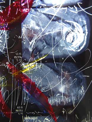 Walter Stach: for Jochen. 2016. Reworked x-ray. Detail